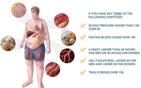 花生作为替代零食可降低我国成年人代谢综合征风险