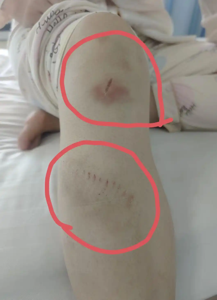 权力下沉岂能沦为推诿护恶的“挡箭牌”?